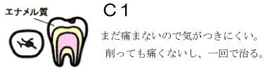 C1